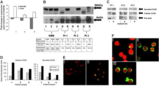 Figure 4. CCN3 mRNA and protein is down-regulated in primary cells from patients with CML, and expression increases upon entering remission. (A) RNA was extracted from bone marrow samples taken from patients with CML at diagnosis and following treatment (patient 1 hematopoietic response, HR; patients 2 and 3 complete cytogenetic response, CCR), and real-time PCR was performed to determine CCN3 and BCR-ABL mRNA levels. Results are presented as the fold change in BCR-ABL () and CCN3 (□) expression following treatment (mean of 3 determinations ± SD). (B) Protein lysates extracted from CML patient bone marrow samples taken at diagnosis (“D”) and following response to treatment (“R”) were subjected to Western blot analysis to identify CCN3 protein expression. Three normal bone marrow samples are included for comparison. Patient 1, HR; patients 2 and 3, CCR. (C) CD34+ cells were extracted from the bone marrow of 3 patients with CML at diagnosis and treated for 72 hours in vitro with imatinib (1 μM). Western blot analysis of the medium in which the cells were grown and protein cell lysates was performed to identify CCN3 protein. Optical densitometry was performed on the Western blot. The mean signal from NBM was assigned 100% and measurements were expressed as a percentage compared to the signal from NBM. (D) Optical densitometry was performed on the Western blot from panel C. CCN3 expression in CD34+ cells grown without imatinib were assigned 100%. CCN3 expression in CD34+ cells treated with imatinib for 72 hours was expressed as a percentage compared with cells that were not treated. (E) Confocal microscopy was used to detect CCN3 expression (green fluorescence) in mononuclear cells from a patient with CML at diagnosis (i) and following a complete cytogenetic response (ii). Images were collected using a Bio-Rad Microradiance confocal laser scanning microscope with an oil immersion lens (magnification, × 80). Propidium iodide was used to stain the nuclei. (F) Confocal microscopy was used to detect CCN3 protein (green fluorescence) in CD34+ cells from a patient with CML at diagnosis (i), normal bone marrow (ii), and a patient with thrombocythemia (iii). Images were collected using a Bio-Rad Microradiance confocal laser scanning microscope with an oil immersion lens (magnification, × 110). Propidium iodide was used to stain the nuclei.