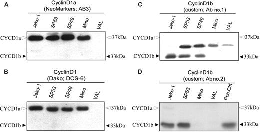 Figure 1. Expression of cyclin D1 isoforms by cultured MCL cells. Four MCL cell lines (Jeko-1, SP53, SP49, and Mino) and the control, germinal center-derived diffuse large B-cell lymphoma cell line (VAL) were examined for expression of cyclin D1 protein isoforms using commercially available antibodies against cyclin D1a (A) and cyclin D1, which was not further characterized (B), and 2 different custom-made, cyclin D1b-specific antibodies (C4, D7). Bands corresponding to cyclin D1a (37 kDa) and cyclin D1b (33 kDa) are marked by the open and solid arrowheads, respectively. Results are representative of 2 to 4 independent experiments.