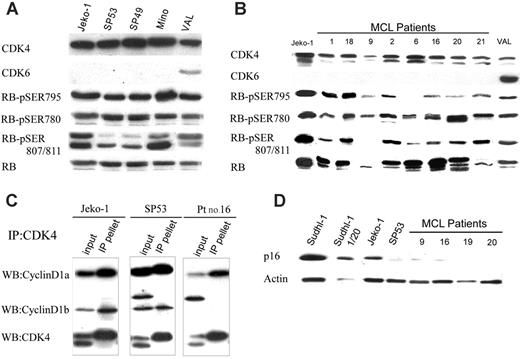 Figure 3. Expression and activation status of the cyclin D1 target proteins CDK4 and RB in MCL cells. Expression of CDK4, CDK6, and RB (both total and phosphorylated at the depicted serines) by MCL cell lines (A) and primary MCL samples (B). (C) Persistent association of cyclin D1 isoforms with CDK4 in MCL cells. Cell lysates from 2 MCL cell lines (Jeko-1 and SP53) and one MCL patient (patient16) immunoprecipitated with the anti-CDK4 antibody and probed in Western blot with antibodies against cyclin D1a (top row), cyclin D1b (middle row), and CDK4 (bottom row). Detected protein bands are depicted in the rows designated IP pellet. Expression of the proteins in the cell lysates not subjected to the CDK4 antibody precipitation served as the control (rows designated as input). (D) Expression of the p16 protein by the depicted MCL cell lines and primary tumor samples. Cell lysate from the p16 protein-expressing SUDHL-1 cell line used at the matching protein concentration (first lane) and after 1:20 dilution (second lane) served as control. Results are representative of at least 2 independent experiments.