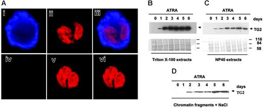 Figure 2. The distribution of TG2 in nuclear fractions of maturing NB4 cells. (A) Localization of TG2 by confocal microscopy. NB4 promyelocytes were cultured in the presence of 1 μM ATRA for 6 days. (i-iii) Cells were fixed, permeabilized, and labeled for TG2 with monoclonal antibodies followed by Alexa Fluor 633–tagged GAMIG (i, blue), and were also stained with PI (ii, red). Panel iii is the overlay image. Note that TG2 is present in the nucleus. In the control, unspecific labeling by Alexa Fluor 633-GAMIG was checked by omitting anti-TG2 antibody (iv). Panel v shows the nucleus of the same control cell, and panel vi, the overlay image of panels iv and i. The thickness of the optical sections shown is 800 nm. (B-D) Extraction of TG2 from nuclei of NB4 cells treated with ATRA. Nuclear samples were fractionated into (B) Triton X-100, (C) NP40-soluble, and (D) nuclear matrix compartments as described in “Materials and methods.” Briefly, the Triton X-100–soluble lipids and proteins were extracted, and then NP40-soluble fractions were obtained. The remaining insoluble protein remnant was suspended in nuclear buffer and sonicated for a short time to get the soluble DNA and protein fraction. Last, with the help of 5 M NaCl, the high salt–soluble protein was extracted from this suspension. The last 2 fractions contained mostly the nuclear matrix, chromatin, and associated proteins.32 From each fraction, 25 μg protein was analyzed by Western blotting using monoclonal antibody to detect TG2. To confirm that the fractions were free of cytoplasmic contamination and that they contained a different protein pattern, the blotted membranes were stained by Coomassie blue and immunoblotted for β-tubulin (not shown).