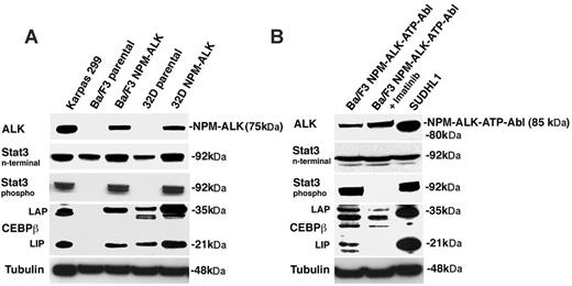 Figure 4. ALK, Stat3-phosphorylated and C/EBPβ expression in NPM-ALK and NPM-ALK-ATP-Abl–transformed Ba/F3 and 3D cells. (A) Western blot analysis of NPM-ALK–transformed Ba/F3 and 32D cell lines. Each lane contains 30 μg protein extract. The ALCL cell line Karpas 299 is used as control. The NPM-ALK construct produces a band of 75 kDa. Tubulin is used as loading control. (B) Western blot analysis of Ba/F3 NPM-ALK-ATP-Abl–transformed cell line untreated or treated with 5 μM imatinib for 12 hours. The NPM-ALK-ATP-Abl construct produces a positive protein band of 85 kDa, 5 kDa larger than the protein band detected in the SUDHL-1 cell line used as control. Tubulin is used as loading control.