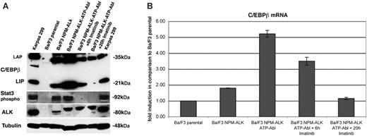 Figure 5. Qualitative reverse transcription–polymerase chain reaction (qRT-PCR) analysis of C/EBPβ mRNA levels and protein expression in NPM-ALK and NPM-ALK-ATP-Abl–transformed Ba/F3 cells. (A) Western blot analysis of transformed Ba/F3 cells. Each lane contains 30 μg protein extract. The ALCL cell line Karpas 299 is used as control. Stat3 phosphorylate is used as control for the kinase activity of NPM-ALK. The NPM-ALK-ATP-Abl construct produces a positive protein band of 85 kDa. Tubulin is used as loading control. (B) qRT-PCR analysis of C/EBPβ was performed relative to the TBP housekeeping gene. Data were analyzed according to the ΔCT method. Results are depicted as mRNA fold induction compared with Ba/F3 parental cells. Error bars indicate SD.