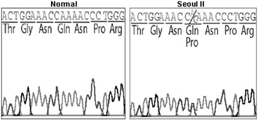 Figure 1. DNA sequencing. DNA sequence analysis of exon 5 of the Aα-chain gene in Seoul II mutation and normal control. Seoul II is shown to have a heterozygous point mutation, with the conversion of CAA to CCA resulting in Gln to Pro substitution at Aα residue 328.