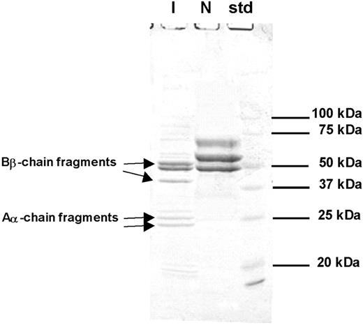 Figure 2. SDS-PAGE of reduced fibrinogen from index subject (I) and normal control (N). Aα- or Bβ-chain fragments were identified through N-terminal sequencing. Intact Aα- or Bβ-chain bands are seen in the normal control, but not the index subject. N-terminal sequence of each band is as follows: 24 kDa, ADSGEGDFLA; 25 kDa, ADSGEGDFLA; 38 kDa, DNENVVNEYS; 50 kDa, ARPAKAAATQ.