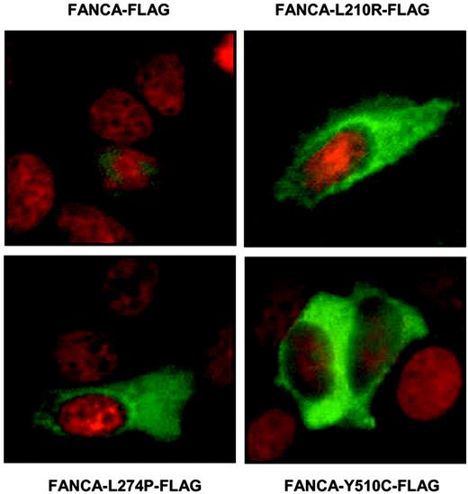Figure 6. Cytoplasmic expression of FLAG-tagged FANCA mutant proteins in transiently transfected MCF-7 cells by indirect immunofluorescence. The different FLAG-tagged FANCA mutant proteins are shown in green. The counterstaining with Hoechst is shown in red to visualize the nuclei.