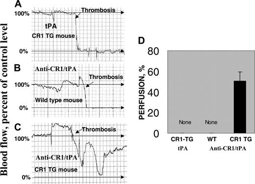 Figure 6. Prophylactic thrombolysis of occlusive arterial clots by anti-CR1/tPA in TgN-hCR1 mice. Occlusive thrombi were formed in the carotid artery of TgN-hCR1 (A, C) or WT (B) mice by applying FeCl3 to the adventitia. Rapid and complete cessation of perfusion was seen in both TgN-hCR1 and WT mice (A, B). Thirty minutes before injury, tPA (A) or anti-CR1/tPA (2 mg/kg tPA) (B, C) was injected. (A-C) Examples of Doppler ultrasound monitoring of blood perfusion. A square unit in the chart corresponds to 160 seconds. (D) Cumulative data of perfusion downstream of the thrombotic site collected in the 3 groups of animals (n = 5 per group). The flow in the vessel prior to thrombosis and the baseline of Doppler signal are considered as 100% and 0% perfusion, respectively. Percent of perfusion in panel D represents the maximal value of flow attained within 30 minutes after thrombosis.