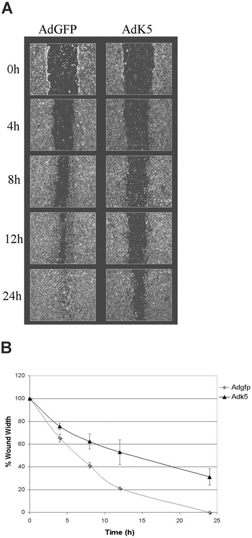 Figure 3. K5 inhibits migration of endothelial cells. HUVECs were transduced with AdEGFP or AdK5 as described in “Materials and methods.” The monolayers were scratched using a pipet tip and the resealing of the wounds was monitored over the indicated time points by phase microscopy. (A) Photographs were taken at regular intervals of the identical region of a representative part of each wound. (B) The width of each wound was measured and plotted as the percentage of the initial wound width versus time. The average of 3 independent experiments is shown.