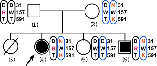 Figure 2. The Tunisian family pedigree shows cosegregation of the 3 carboxylase mutations with VKD coagulation factor deficiency. Affected and unaffected subjects are indicated by solid or open symbols, respectively. The arrow points to the proposita. The female indicated by the hatched circle was dead in early infancy for unknown reasons. Mutated residues are in red, and the chromosomal colors indicate maternal (blue) or paternal (black) inheritance.