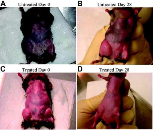 Figure 1. Rapamycin decreases lymphoproliferation. CBA-lprcg mice were randomized to treatment with rapamycin versus vehicle control. After 4 weeks of treatment a decrease in adenopathy is visually apparent.