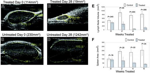 Figure 2. Rapamycin decreases lymphoproliferation. (A-D) Serial ultrasounds were performed every 2 weeks to document lymph node volume in cubic millimeters and splenic area in square millimeters, comparing rapamycin-treated with untreated mice. Treated mice showed a statistically significant (P = .05) decrease in lymph node volume after 2 weeks of treatment when compared with control mice (E). Treated mice also showed a statistically significant (P = .03) decrease in splenic area by 4 weeks of treatment when compared with control mice (F). No statistical difference existed between groups at initiation of treatment. Bars represent mean lymph node volume or splenic areas from mice at each time point and error bars represent SEM. Average normal mouse spleen size in unaffected animals was 10 to 20 mm2. (A) Representative example of a lymph node prior to treatment with rapamycin. (B) The same node from panel A after 4 weeks of treatment. Initial volume of the node was 114 mm3 and the volume after treatment was 19 mm3, representing an 80% reduction in size. (C) In contrast to panels A-B, a lymph node of a mouse prior to treatment with vehicle. (D) The same node from panel C after 4 weeks. Initial volume of this node was 230 mm3 and the volume after exposure to vehicle was 1242 mm3, representing a 600% increase in size.