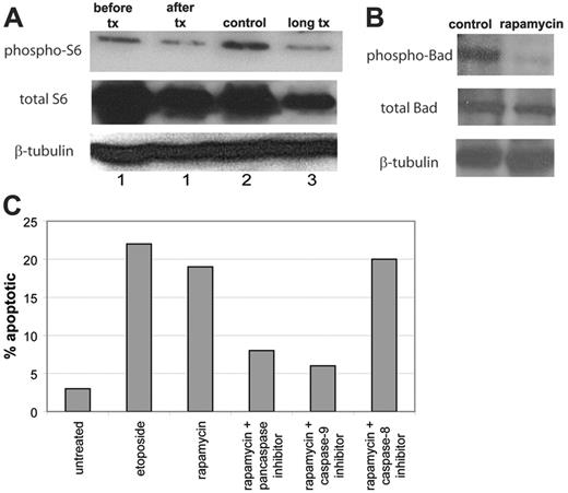 Figure 7. Mechanism of action of rapamycin in ALPS. (A) Rapamycin down-regulates phospho-S6. Lymph node cells were harvested from a mouse (no. 1) both before (before tx) and after (after tx) treatment with rapamycin for 3 days. Lymph node cells were also harvested from a mouse treated with rapamycin for 4 weeks (no. 3, long tx) compared with a mouse treated with vehicle for 4 weeks (no. 2, control). Immunoblot of phospho-S6 (Ser 235/236) (top bands), total S6 (middle bands), and β-tubulin (bottom bands) from the mice demonstrates a correlation between biochemical and clinical response to rapamycin in the mice. Lymph cells from treated mice had down-regulation of phospho-S6 compared with lymph cells from untreated mice. (B) Rapamycin down-regulates phospho-Bad. Lymph node cells were harvested from a mouse treated with rapamycin for 4 weeks and a mouse treated with vehicle for 4 weeks. Immunoblot of phospho-Bad (Ser 112; top bands), total Bad (middle bands), and β-tubulin (bottom bands) from the mice demonstrates down regulated phospho-Bad in the rapamycin-treated cells. Results for phospho-Bad (Ser 136) were similar and are not shown. (C) Rapamycin induces caspase-dependent apoptosis in cultured murine ALPS lymphocytes. T cells from lymph node biopsy of CBA-lprcg mice were maintained in culture. Aliquots of 105 lymphocytes were exposed to 100 ng/mL rapamycin for 48 hours and were assessed for apoptosis by flow cytometric staining for annexin V. In addition, prior to treating with rapamycin, aliquots of cells were pretreated for 2 hours with a pancaspase inhibitor, a caspase-9 inhibitor, or a caspase-8 inhibitor. Data represent percentage of apoptotic (annexin V–positive/7-AAD–negative) cells determined by flow cytometric analysis.