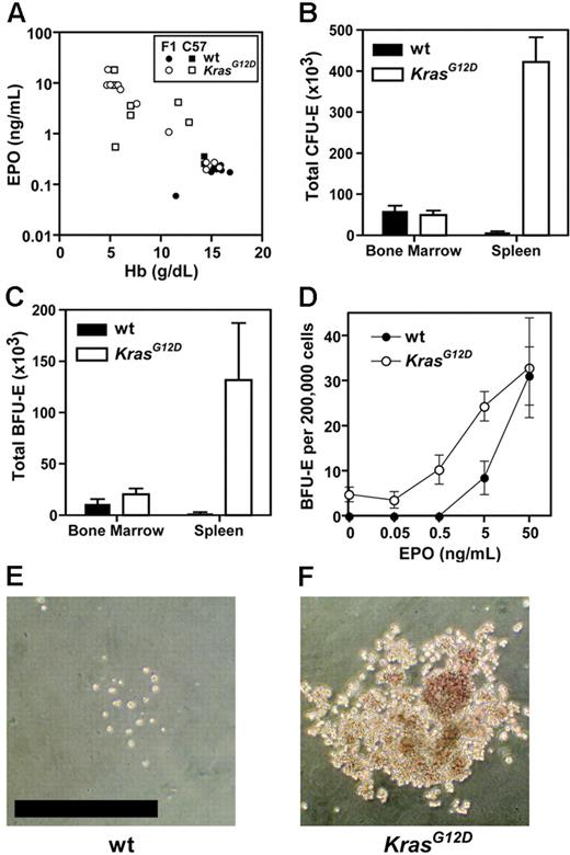 Figure 1. Serum EPO and erythroid progenitors in Mx1-Cre, KrasG12D mice. (A) Serum EPO and hemoglobin (Hb) concentrations in Mx1-Cre, KrasG12D mice (open symbols) and wild-type (wt) littermates (closed symbols); data are pooled from F1 (n = 18; circles) and C57BL/6 (n = 9; squares) mice. (B) Total CFU-Es recovered from bone marrow (2 femurs and 2 tibias) and spleens of Mx1-Cre, KrasG12D mice (□) and wild-type littermates (▪) shown as mean ± SEM. (C) Total BFU-Es are enumerated as in panel B. (D) EPO dose-response of BFU-Es derived from C57BL/6 bone marrow, showing mean ± SEM from 3 independent experiments. (E,F) Photomicrographs of typical BFU-Es from bone marrow cultured with 50 ng/mL EPO for 7 days (bar represents 500 μm).