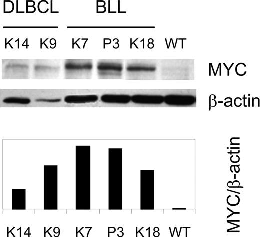 Figure 6. Elevated expression of MYC protein in TCL1-tg DLBCL and BLL. A Western blot for MYC and β-actin expression is shown for BLL (K7, P3, and K18), DLBCL (K9, K14) and control (WT) spleen cells.12 The ratio of MYC to β-actin expression was determined by densitometry.