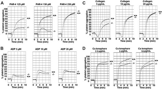 Figure 6. TSSC6–/– platelets display normal platelet aggregation responses to PAR-4, ADP, type 1 collagen, and calcium ionophore. Aggregation responses of PRP (platelet count adjusted to 100 × 109/L) for wild-type and TSSC6–/– mice were determined following activation with different concentrations of various agonists: PAR-4 agonist peptide (125-250 μM), ADP (5-20 μM), type 1 collagen (5-20 μg/mL), and calcium ionophore (2.5-10 μg/mL), respectively.