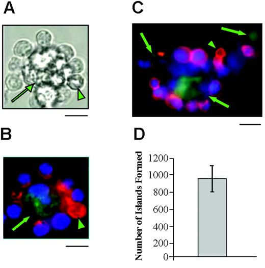 Figure 3. Reconstituted erythroblastic islands. Bright field (A) and immunofluorescent standard (B) and confocal (C) micrographs of typical erythroblastic islands formed from single cell suspensions of MacGreen mouse bone marrow. Immunofluorescent micrographs of islands show cells stained for erythroid-specific marker GPA (Ter119; red), macrophage marker M-CSF receptor GFP transgene expression (green), and DNA (Hoechst 33342; blue). In the confocal image some of the cells appear blurred because they are not in the plane of focus. However, macrophage staining is apparent in various regions of the island. Reticulocytes, arrowheads; macrophage, arrows; bars represent 10 μm. (D) Histogram shows number of erythroblastic islands formed from 1 × 105 single cells; n = 10. Results are shown as mean ± SD.