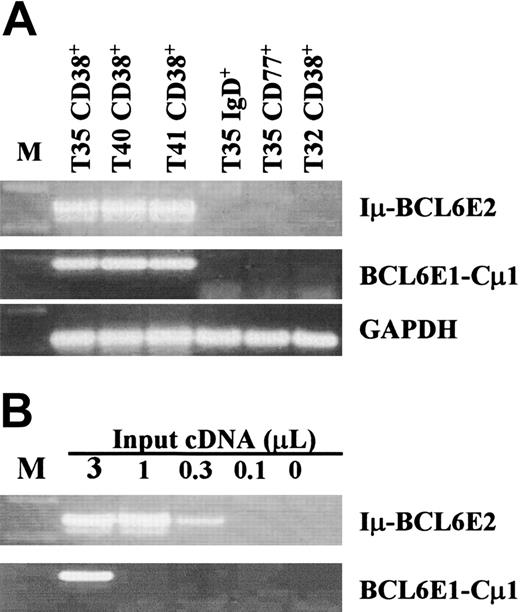 Figure 2. Coexpression of the Iμ-BCL6E2 with BCL6E1-Cμ1 transcripts. (A) The magnetic bead–purified B-cell subpopulations as indicated were simultaneously subjected to detection for the expression of both types of chimeric transcripts. Equal amounts of cDNA (3 μL) from each sample were input. (B) Sensitivity comparison of the assays for both types of chimeric transcripts. Serially diluted cDNA from the same sample as indicated was compared for sensitivity, where sensitivity for the Iμ-BCL6E2 was about 9-fold higher than that of the BCL6E1-Cμ1 transcripts.
