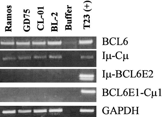 Figure 3. Trans-splicing is not likely the responsible mechanism for the generation of chimeric transcripts. Burkitt lymphoma cell lines (Ramos, DG75, CL-01, and BL2) cells, while expressing both BCL6 and germ-line IgM transcripts, do not express the chimeric Iμ-BCL6E2 or BCL6E1-Cμ1 transcripts. Tonsil no. 23 (T23) cells were included as a positive control. The results represent 3 independent experiments.