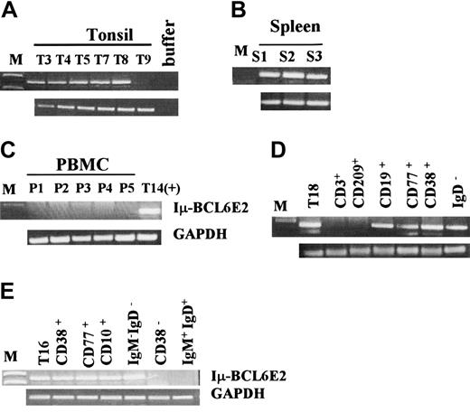 Figure 5. Characterization of the Iμ-BCL6 transcript producing cells from normal lymphoid tissues and PBMCs. Chimeric Iμ-BCL6 transcripts detected from the representative tonsil (A), spleen (B), and PBMC (C) donors are shown. Associations of the chimeric Iμ-BCL6 transcripts with the tonsillar B-cell subpopulations positively selected by magnetic beads (D) and sorted by FACS (E) are presented.