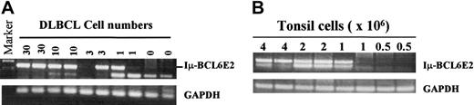 Figure 6. Sensitivity of the RT-PCR assay for the chimeric transcripts. (A) The sensitivity for Iμ-BCL6E2 with DLBCL cells. The RNA equivalent for the indicated DLBCL-cell number was diluted into RNA from 1 × 106 DG75 cells for the assay done in duplicate. (B) The assay sensitivity for tonsillar cells. The tonsillar cells were serially diluted as indicated; the highest dilution (eg, lowest cell number) with a positive Iμ-BCL6E2 signal from at least one sample of the duplicates is scored as the end dilution.