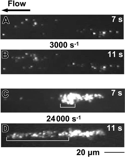 Figure 1. Platelet aggregation precedes stable adhesion. Blood containing the anticoagulant PPACK (93 μM) and the fluorescent dye mepacrine (10 μM) was perfused over collagen type 1 fibrils (2.5 mg/mL coating concentration). After 7 seconds of flow, single platelets adhere when the shear rate is 3000 s–1 (A), but an aggregate has formed at 24 000 s–1 (C). After 4 additional seconds, few more platelets are present on the surface exposed to the lower shear rate (B), and those already adherent have remained stationary. In contrast, in the aggregate exposed to the higher shear stress (D), hydrodynamic forces have stretched a group of platelets, identified by brackets of different length in panels C and D. Images from Video S1.