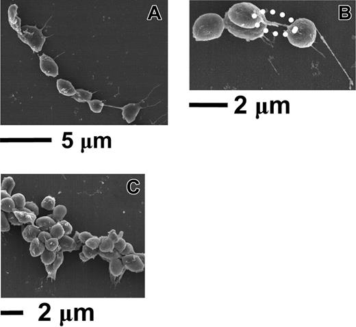 Figure 4. Scanning electron microscopy analysis of activation-independent aggregates. Blood containing PPACK and PG E1 was perfused over immobilized VWF (see legend to Figure 2). This was immediately followed by perfusion-fixation with a buffered 4% paraformaldehyde solution before processing for electron microscopic analysis. The transition from activation-independent rolling aggregates to fixed formations on the surface was documented by microscopic evaluation in real time. Panels A and B show elongated aggregates formed by discoid (nonactivated) platelets with membrane protrusions that link platelets to one another. In panel B, 2 such protrusions originating from adjacent platelets (highlighted by a dotted line) appear to be in contact. Panel C shows a rolling aggregate in which platelets are in close contact with one another with only few and short membrane protrusions.