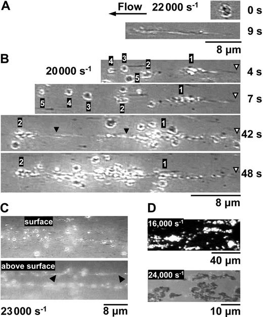 Figure 5. RICM analysis of activation-independent platelet aggregation. (A-C) Perfusion of blood containing PPACK and PG E1 over immobilized VWF (see legend to Figure 2). (A) Upper panel. Initial adhesion of a single platelet. Lower panel. A limited area of firm attachment holds the platelet in contact with the surface while stretching occurs under the effect of hydrodynamic force (bottom panel). Wall shear rate = 22 000 s–1. Images from Video S6, part 1. (B) Top panel: a stretched platelet (labeled 1) is shown 4 seconds after the initial adhesion, and an arrowhead indicates the point of surface attachment. Other platelets, labeled 2 to 5, are attached to platelet 1, but connecting links are not discernible in this focal plane. Second panel: Between 4 and 7 seconds, the aggregate has been stretched downstream, and platelet 5 has changed position. Third panel: Between 7 and 42 seconds, platelet 2 has been stretched considerably; arrowheads highlight the long link with platelet 1. Other platelets attach transiently to stretched platelets 1 and 2, which are stationary on the surface. Bottom panel: Between 42 and 48 seconds, numerous platelets attach to the “backbone” formed by stretched platelets 1 and 2, resulting in a larger aggregate. Wall shear rate = 20 000 s–1. Images from Video S6, part 2. (C) View of the interplatelet contacts in an activation-independent aggregate. Top panel: The links between platelets are not uniformly discernible on the surface. Bottom panel: The stretched platelets that form the “backbone” of the aggregate (arrowheads) are visible in a focal plane above the surface. Wall shear rate = 23 000 s–1. Images from Video S6, part 3. (D) Perfusion of blood containing PPACK but no PG E1. Top panel: Fluorescence image of platelets firmly attached to immobilized VWF. Shear rate = 16 000 s–1. Bottom panel: RICM image. The adherent platelets are spread and in close contact with the surface, thus appear uniformly dark. Shear rate = 24 000 s–1. Images from Video S7.