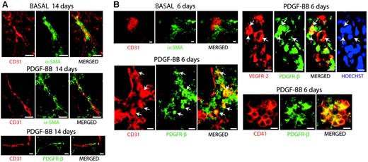 Figure 3. Colocalization of PDGFR-β with CD31, VEGFR-2, and CD41 in hemangioprecursor cells. (A) Embryoid bodies cultured for 14 days in the absence (top panel) or presence (middle and bottom panels) of 30 ng/mL PDGF-BB were analyzed by immunofluorescent staining for CD31 (red) and α-SMA (green) in the 2 upper panels and for CD31 (red) and PDGFR-β (green) in the bottom panel. At this late time point, PDGFR-β expression was confined to perivascular α-SMA–positive cells. (B) Embryoid bodies cultured for 6 days in the absence (top panel) or presence of 30 ng/mL PDGF-BB were analyzed for expression of CD31 (red) and α-SMA (green), CD31 (red) and PDGFR-β (green), VEGFR-2 (red) and PDGFR-β (green), and for CD41 (red) and PDGFR-β (green), as indicated. At day 6 in the presence of PDGF-BB, colocalization was evident in clusters of immature hemangioprecursor cells. Merged images are shown to the right in each panel. Where indicated, cells were treated with Hoechst 33342 to visualize nuclei. Bars represent 20 μm.