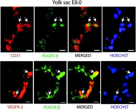 Figure 6. Coexpression of PDGFR-β with CD31 and VEGFR-2 in the E8 yolk sac. Immunostaining of sections from yolk sacs derived from E8 embryos. Top panel: Visualization of cells coexpressing CD31 (red) and PDGFR-β (green) by confocal microscopy. Bottom panel: Coexpression of VEGFR-2 (red) and PDGFR-β (green) in the yolk sac. Nuclei are visualized by Hoechst 33342 staining (blue). Arrows indicate coexpressing cells. Bars represent 10 μm.