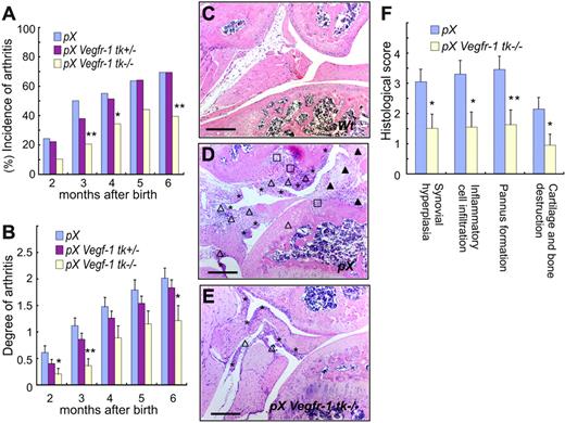 Figure 2. Signals from VEGFR-1 TK contribute to the onset and progression of arthritis. (A) The incidence of arthritis was significantly lower in pX Vegfr-1 tk–/– mice than pX mice. In addition, the incidence of arthritis in pX Vegfr-1 tk+/– heterozygotes was slightly lower in the early stages. (B) Clinical grades of arthritis were reduced depending on the deficiency of the VEGFR-1 TK domain from 2 to 6 months after birth. pX Vegfr-1 tk+/– mice showed mild clinical scores between those of pX and pX Vegfr-1 tk–/– mice. The data (A-B) represent the mean ± SEM obtained from 33 to 122 mice. *P < .05 versus pX; **P < .01 versus pX. (C-E) Cross-sections of ankle joints in control and RA mice. Joints of wild-type mice (C) show no remarkable change. Joints of pX mice (D) show synovial hyperplasia (*), inflammatory cell infiltration (▵), pannus formation (▴), and loss of cartilage and bone (□). These findings are milder in pX Vegfr-1 tk–/– mice (E). Sections are taken from average cases in these mice. Scale bars, 200 μm. Images in panels C-E were taken with a Nikon Eclipse TE600 microscope (Nikon, Tokyo, Japan) using AxioVision 3.0 software (Carl Zeiss, Jena, Germany) and a 10×/0.30 NA objective lens, then processed with Photoshop CS (Adobe Systems, San Jose, CA). (F) Histologic scores of the degree of pathology in paws and ankles. Scores of pX Vegfr-1 tk–/– mice were about half those of the pX mice. The data represent the mean ± SEM. *P < .05 versus pX; **P <.01 versus pX.