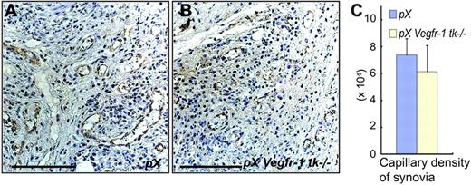 Figure 3. No significant difference was observed in newly formed vessel densities in the hyperplastic synovia and pannus between pX mice and pX Vegfr-1 tk–/– mice. (A-B) Staining for VWF in the newly formed capillary vessels in the hyperplastic synovia and pannus. Scale bars, 50 μm. Images were taken with a Nikon Eclipse TE600 microscope, using AxioVision 3.0 software and a 40×/0.75 NA objective lens, then processed with Photoshop CS. (C) Vascular densities in the hyperplastic synovia are slightly lower in pX Vegfr-1 tk–/– mice than in pX mice (P = .623). The data represent the mean ± SEM.
