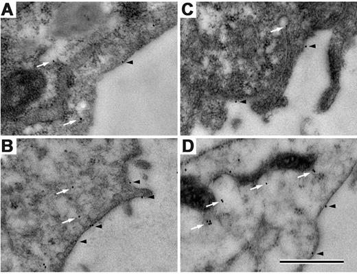 Figure 4. Immunolocalization of B1R and B2R in IMR-90 cells. Ultra-thin sections of unstimulated (A,C) or stimulated with 1% (vol/vol) exudates from monocytes treated with 1% (vol/vol) S aureus supernatant from an overnight culture (B,D). IMR-90 cells were incubated with antibodies against B1R (A-B) or B2R (C-D). Bound antibodies were visualized by secondary antibodies labeled with 10-nm gold particles and processed as described in “Materials and methods.” Examples of intracellular (arrows) and membrane-associated receptors (arrowheads) are indicated. The scale bar indicates 0.5 μm (magnification ×25 000).