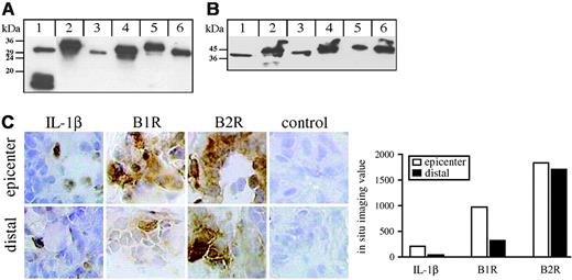 Figure 7. Detection of TSST-1 and SEB in supernatants from clinical S aureus isolates and expression of B1Rs and B2Rs in a patient suffering from an S aureus soft-tissue infection. (A-B) Supernatants from the clinical isolates 9730, 1878, 2374, 1024, and 15159 (lane 2 to 6) were separated on SDS-PAGE, transferred onto nitrocellulose membranes, and immunostained with antibodies against TSST-1 (A) or SEB (B). The strain ATCC 700699, whose genome has been completely sequenced, was used as a control (lane 1). Note that the apparent molecular weights of toxins vary between the tested strains. Size variation is a common feature of bacterial proteins from different strains that is often caused by homologous recombination between repeated regions within the gene39 and has normally no influence on the activity of the protein. (C) Tissue biopsies from the epicenter of the infection site and from a distal site were obtained from a patient with a soft-tissue infection caused by S aureus. The biopsies were cryosectioned and immunohistochemically stained for IL-1β, B1R, and B2R. Omission of the primary antibody was included as a negative control and was always completely negative. Stainings were quantified by in situ imaging and the results are presented as the imaging value: area and intensity of the positive stain (brown) in relation to the total cell area (blue), as previously described.26