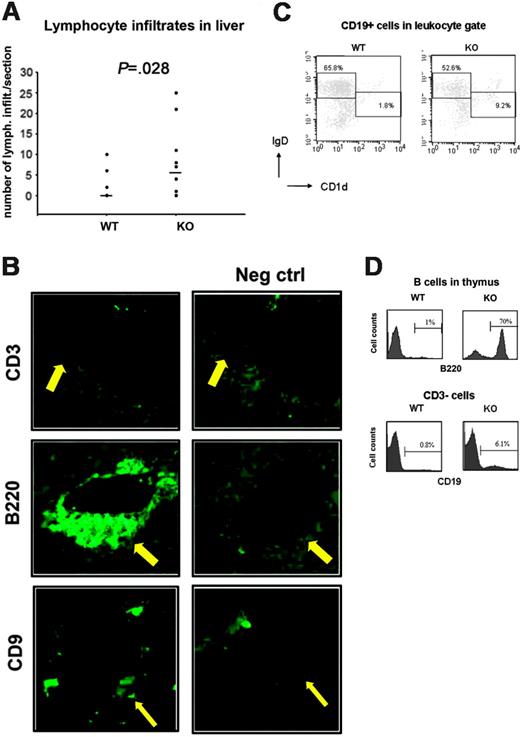 Figure 2. B cells infiltrate liver and thymus of aged Aire-deficient mice. (A) Number of lymphocytic infiltrates in liver sections. n = 11 WT, 11 KO. Each symbol corresponds to a different animal, and median is indicated by horizontal lines. P value was calculated with Mann-Whitney test. (B) Immunofluorescent stainings for CD3, B220 (×20/1.0 NA objective magnification) and CD9 (×10/1.0 NA objective magnification) were performed on cryostat sections of livers from 3 aged Aire KO mice. Negative control stainings were performed on adjacent sections by adding secondary antibody in the absence of primary antibody. In addition, the negatively staining anti-CD3 antibody is an isotype control of the anti-B220 and anti-CD9 antibodies. Arrows point at the site of lymphocytic infiltration. (C) The follicular versus marginal zone phenotype of the liver B-cell infiltrates was measured by FACS. Leukocytes were gated on forward scatter/side scatter (FSC/SSC) by comparison with a spleen, and then CD19+ cells were further gated. n = 6 WT, 5 KO. Two representative mice are shown. (D) Aire WT or KO thymi were FACSed for B220 expression (1 KO and 1 WT shown). Histograms shown are gated on lymphocytes from FSC/SSC. In an additional experiment, Aire WT or KO thymi were investigated by FACS for CD19 expression. Histograms shown are gated on CD3– lymphocytes.