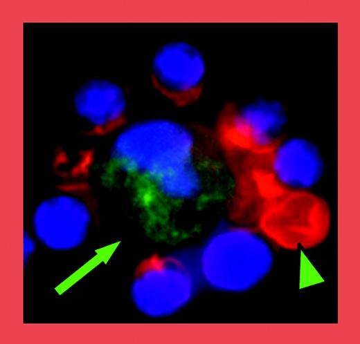 Immunofluorescent analysis of an erythroblast island consisting of a central macrophage (green; arrow) surrounded by erythroid cells (red), one of which has enucleated (arrowhead). See the complete figure in the article beginning on page 2064.