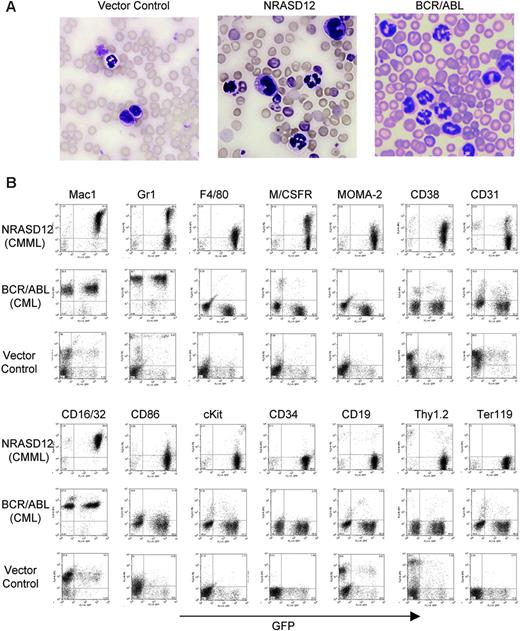 Figure 3. Characterization of the NRASD12-induced CMML-like disease in mice. (A) Morphology of the peripheral WBCs of a representative vector control, NRASD12 and BCR-ABL mouse. Images were taken under a Zeiss Axioskop microscope (Carl Zeiss, Thornwood, NY) using a Zeiss Microscope Camera System and a 40×/1.0 oil-immersion objective lens. Images were processed with Adobe Photoshop 7.0 software (Adobe, San Jose, CA). (B) Flow cytometry analysis on the peripheral WBCs freshly isolated from a representative diseased NRASD12 mouse, BCR/ABL mouse, and a vector control mouse as indicated. The level of GFP expression is shown along the x-axis, and the y-axis shows the expression of cell-surface markers specified over each column.