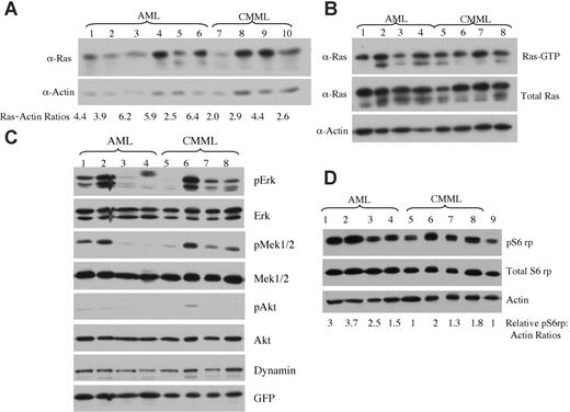 Figure 7. Expression levels of oncogenic NRAS and activation of downstream effectors in AML versus CMML mice. (A) Lysates of tumor cells isolated from livers of mice with AML or CMML were run on a 6% to 18% gradient polyacrylamide gel and transferred to a nitrocellulose membrane. The membranes were blotted with anti-Ras and antiactin antibodies to show the expression of oncogenic NRAS with actin as loading control. The ratio of relative expression of 2Xmyc-NRASD12 to that of actin was calculated using the NIH Image 1.63 software. (B) Level of activated Ras in AML and CMML samples was measured by using Raf1-RBD to pull down GTP-bound Ras proteins. (C-D) Activation of effector pathways downstream of Ras was tested in AML and CMML samples by immunoblotting for the indicated proteins. Relative ratios of pS6rp and actin are indicated (D). Samples in lanes 1 to 8 of panels B, C, and D were the same. Lane 9 in panel D is the sample from a vector control mouse.