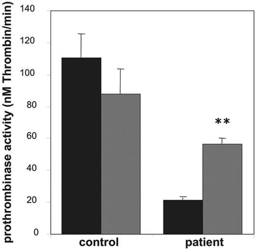 Figure 5. Effect of valinomycin on collagen-plus-thrombin–induced procoagulant activity of platelets from a patient with Scott syndrome. Prothrombinase activities, expressed as nanomolar thrombin formed per minute, were determined after activation with collagen (10 μg/mL) plus thrombin (4 nM) in the absence (▪) and presence (▦) of valinomycin (3 μM). Data are mean values ± 1SD(n = 6).