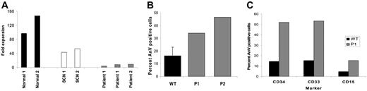 Figure 2. Presence of the Ile294Thr or Ser272Pro WASp mutation profoundly impaired myelopoiesis and led to increased levels of hematopoietic cell apoptosis. (A) CD34+ cell expansion after 14 days in liquid culture. (B) Annexin V–positive cells following anti-CD95 administration to cultured PB lymphocytes. Error bar indicates 1 SD from 33 healthy donors. (C) Spontaneous apoptosis in bone marrow progenitor cells.