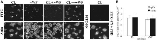 Figure 1. Deposition of plasma fibronectin on platelets adherent to collagen or VWF under static conditions. (A) Coverslips were coated with fibrillar type I collagen (CL), VWF, both proteins simultaneously, or collagen and then VWF. Platelets and 25 μg/mL (50 nM) FITC-fibronectin (FITC-FN) without or with 1 μM FUD and without LPA were added and incubated for 1 hour. Platelets were stained with rhodamine-phalloidin and then examined by epifluorescent microscopy for distribution of FITC-fibronectin and filamentous actin cytoskeleton. Platelets bound to collagen as aggregates. The images were obtained at the level of the coverslip surface. Bar = 10 μm. (B) Platelets were plated on protein-coated wells of a 96-well plate and incubated with or without 50 μg/mL soluble fibronectin (pFN) for 30 minutes without LPA. After 3 rinses, adherent platelets were quantified as described in “Materials and methods.” Values represent the mean ± SD (n = 3).