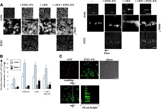 Figure 6. Effect of perfused VWF and fibronectin on thrombogenesis on collagen under shear conditions and localization of VWF and fibronectin. A suspension of platelets and red blood cells with or without 50 μg/mL FITC-fibronectin (FITC-FN) and 200 μg/mL unlabeled fibronectin and/or 10 μg/mL VWF was perfused over surfaces coated with 20 μg/mL collagen at a wall shear rate of 1250 s–1 or 5000 s–1 for 5 minutes. (A) Coverslips were taken out of the chamber, stained with rhodamine-phalloidin, and processed for epifluorescence microscopy. The small and large pictures were taken with 10 × (bar = 100 μm) and 100 × (bar = 10 μm) objectives, respectively. (B) Thrombus volume and number of adherent platelets were calculated as described in Figure 3. Values represent the mean ± SD (n = 3-4). *P < .05 compared with when the perfusate contained just VWF. (C) After perfusion, nonpermeabilized platelets were incubated with mouse anti-VWF followed by rhodamine-conjugated anti–mouse IgG antibody. Confocal microscopy was performed as described in “Materials and methods.” The images represent a 1-μm slice taken from 4-μm height of the coverslip. The bottom right panel shows a perpendicular section through the line. Bar = 10 μm.