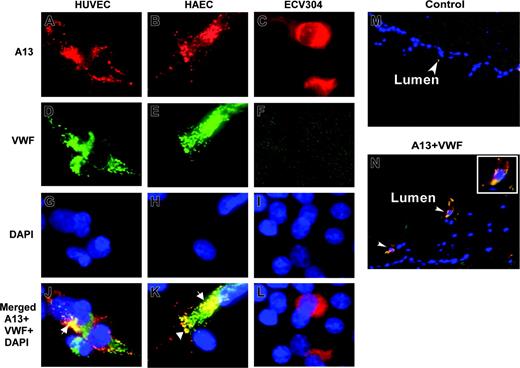 Figure 2. Localization of ADAMTS13 in human endothelial cells by fluorescent microscopy. HUVECs (A,D,G,J), HAECs (B,E,H,K), and ECV304 (C,F,I,L) grown on chamber slides or cryosections of human umbilical veins (M-N) were fixed with ethanol–acetic acid (9:1). The cells or slides were incubated with rabbit anti–ADAMTS13 IgG (20 μg/mL) and mouse anti–VWF IgG (10 μg/mL), followed by incubation of the cells with Cy3-conjugated anti–rabbit IgG and Cy2-conjugated anti–mouse IgG (1:100). The nuclei were stained with 4′, 6′-diamidino-2-phenylindole (DAPI) in the mounting medium. The digital images (40×) were taken under a Nikon inverse fluorescent microscope. ADAMTS13 staining in red is shown in panels A-C. VWF staining in green is shown in panels D-F. Overlapping images for ADAMTS13, VWF, and DAPI staining were shown in panels J-L and N. The yellow staining (white arrows) indicates the areas of ADAMTS13 colocalized with VWF. Cells (not shown) or tissue sections (M) incubated with only secondary antibody were negative.