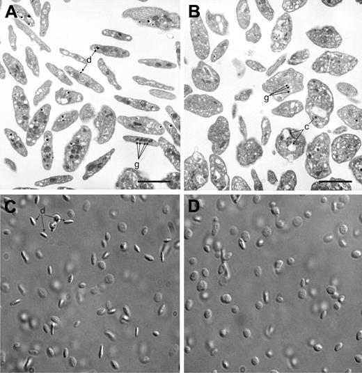 Figure 4. Ultrastructural defects of platelets from Scl–/Δ mice. TEM images of platelets from Scl+/Δ (A) and Scl–/Δ (B) mice. Primary (g) and dense (d) granules are indicated in panel A. Depleted granules (g) and dilated canalicular membrane system (c) are indicated in panel B. Scale bars represent 5 μM. Differential interference contrast (DIC) images of platelets from a Scl+/Δ (C) and Scl–/Δ (D) mice. Arrows in panel C show elongated forms indicative of the normal discoid shape (d), which are absent in panel D, indicating that Scl–/Δ platelets are round. Images are at 100 × magnification.