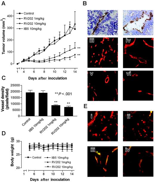 Figure 4. Inhibiting tumor growth by targeting tumor endothelial vimentin. (A) Tumor growth curves of LS174T human colon carcinoma tumor xenografts in nude mice, treated with vehicle, IIB5 anti-BrdU isotype-matched control antibody (10 mg/kg), or RV202 antivimentin antibody (10 mg/kg and 1 mg/kg). Antibodies were administered intraperitoneally every 3 days for a period of 12 days. A dose-dependent inhibition of tumor growth is evident in mice treated with antivimentin antibody (1 mg/kg, **P < .001; 10 mg/kg, **P < .001), whereas treatment with the isotype control antibody did not show inhibition of tumor growth (IIB5; 10 mg/kg, P = .661). (B) Immunohistochemical staining of LS174T tumor xenografts in mice with CD31 (i) and antivimentin antibody RV202(ii) show that vimentin expression is restricted to the endothelium. Microvessel staining with phycoerythrin-labeled CD31 antibody in control mice (iii), isotype control antibody–treated mice (iv), RV202 (1 mg/kg per treatment) (v), and RV202 (10 mg/kg per treatment)–treated mice (vi). (C) Quantification of microvessel density (±SEM) was assessed digitally (**P < .001; Student t test). (D) Body weight of mice during treatment, indicating absence of toxicity. (E) Detection of treatment antibodies targeted to the tumor endothelium. Mouse antibodies were detected (green fluorescence) in mice treated with saline (i), isotype control antibody (ii), RV202 (1 mg/kg per treatment) (iii), and RV202 (10 mg/kg per treatment) (iv). Endothelial cells are stained with phycoerythrin-labeled anti-CD31 antibody in red. Yellow indicates colocalization.