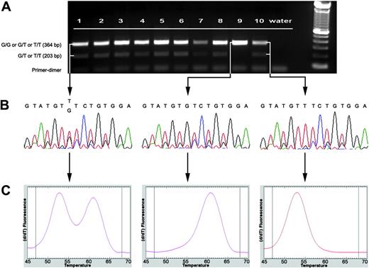 Figure 1. Molecular assay for rapid identification and characterization of JAK2 V617F mutation. (A) Electrophoretogram of AS-PCR for JAK2 V617F mutation in MDS/MPD-Unclassifiable disease. In a healthy patient with the wild-type G/G genotype, only a single 364-bp band is visible (lane 9). A point mutation V617F G→T (either G/T or T/T) is indicated by the presence of a second 203-bp band. Lanes 1-2, MDS/MPD-U; lanes 3-6, RARS-T; lane 7, AML; lane 8, CMML-1; lane 9, normal negative control; lane 10, CIMF (T/T genotype) positive control. (B) Partial sequence of JAK2 exon 14 showing wild-type (G/G) sequence in a healthy patient (middle) and mutated (G/T or T/T) sequences in patient with MDS/MPD-U (right) and CIMF (left). (C) LightTyper DNA melting curves: wild type (middle) is characterized by a single peak (higher melting temperature), G/T genotype (left) by 2 peaks, and T/T genotype (right) by one peak (lower melting temperature).