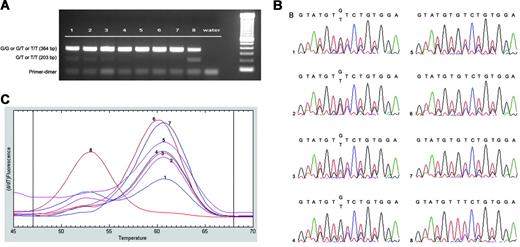 Figure 2. Sensitivity of molecular assay. Sensitivity of (A) AS-PCR, (B) sequencing, and (C) LightTyper melting curves. Genomic DNA isolated from granulocytes of both healthy (G/G) and JAK2 V617F mutated (T/T) patients were mixed at varying ratios respectively: lane 1, 1:1; lane 2, 1:2; lane 3, 1:5; lane 4, 1:10; lane 5, 1:100; and lane 6, 1:500. Lane 7, healthy patient with G/G genotype; and lane 8, CIMF patient with mutated T/T genotype. The 3 methods showed similar sensitivities in detecting a mutated population at a level of 10%.