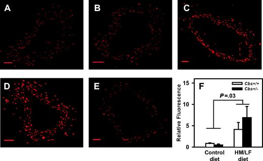 Figure 4. Representative laser-scanning confocal micrographs of carotid arteries stained with DHE. Sections of carotid artery were imaged with a laser scanning confocal microscope using a 10×/0.3 NA objective lens (BioRad, Hemel Hampstead, United Kingdom); images were acquired with BioRad Laser Sharp 2000 software. (A) Cbs+/+ mice fed the control diet. (B) Cbs+/– mice fed the control diet. (C) Cbs+/+ mice fed the HM/LF diet. (D) Cbs+/– mice fed the HM/LF diet. (E) Cbs+/– mice fed the HM/LF diet; sections preincubated with PEG-SOD. Scale bar represents 50 μM. (F) Relative DHE fluorescence (n = 6 in each group). Values are mean ± SEM.