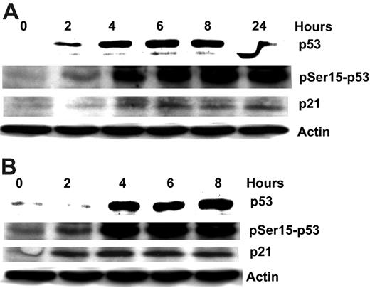 Figure 3. Forodesine increases p53 stabilization and induces p53 phosphorylation on Ser15, with the activation of p21. CLL primary cells were incubated with 2 μM forodesine and 10 μM dGuo at different time points, and the expression of p53, the phosphorylation of p53 at Ser15, and the expression of p21 were measured by Western blot and normalized to actin. Western blot data of 2 patients (no. 1 in A; no. 4 in B) are presented.