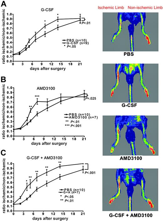 Figure 1. Cytokine treatment and neovascularization. C57BL/6 mice were treated with saline alone (PBS), G-CSF, AMD3100, or G-CSF in combination with AMD3100 (G + A), and perfusion of the ischemic hindlimb relative to the nonischemic hindlimb was measured. Representative laser Doppler images taken 14 days after surgery are shown. Low perfusion is displayed as blue, while the highest level of perfusion is displayed as red. (A) G-CSF versus PBS. (B) AMD-3100 versus PBS. (C) G-CSF + AMD-3100 versus PBS. Data represent the mean ± SEM.