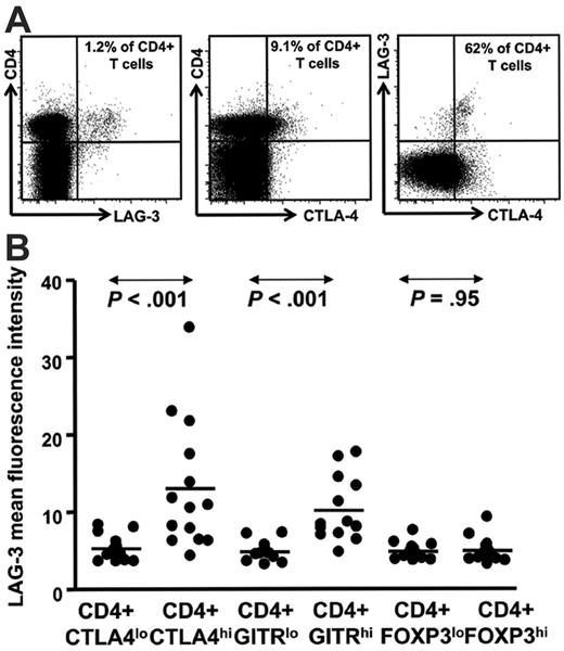 Figure 2. LAG-3 is enriched within the CD4+ T cells expressing intracellular CTLA-4hi and GITRhi. (A) Representative data from an HL patient in remission showing LAG-3 staining and (B) HL patient PBMC samples (n = 14) showing mean fluorescence intensity for LAG-3 on CD4+ T cells with intracellular CTLA-4lo and CTLA-4hi and GITRlo and GITRhi cells. P values were generated using the Wilcoxon matched pairs test.