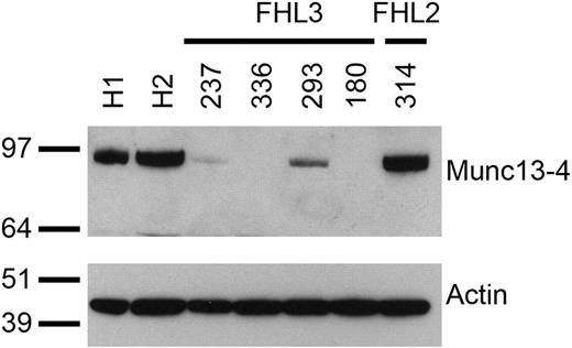 Figure 2. Munc13-4 expression in control and FHL NK cells. Cell extracts from polyclonal NK cells of healthy donors (H1, H2), patients with FHL3 (UPNs 237, 336, 293, 180), and patient with FHL2 (UPN 314) were analyzed by Western blot with anti–Munc13-4 antibody. Blots were reprobed with antiactin antibody. Molecular weight standards are shown on the left (kDa).